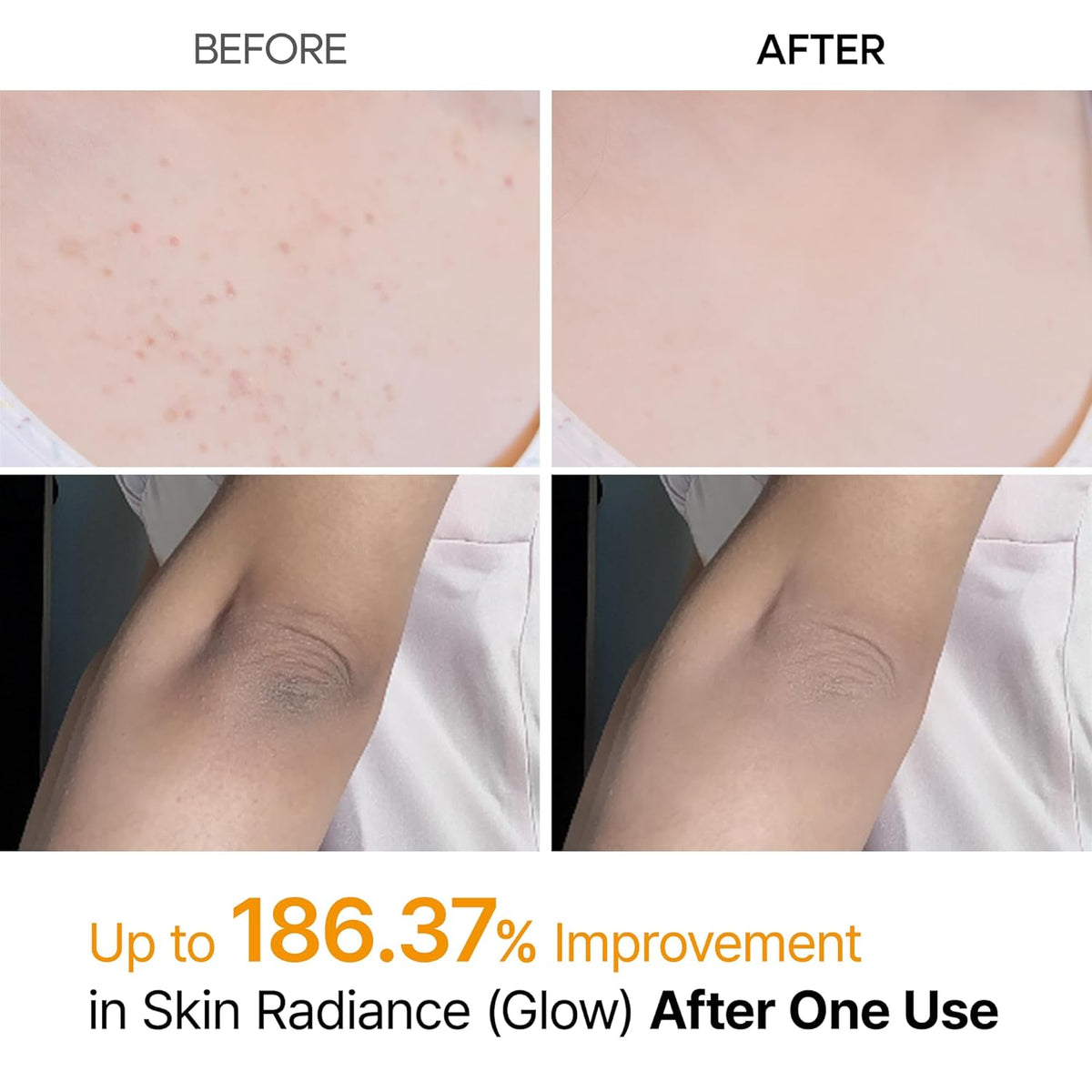 Kojic Acid & Turmeric Exfoliating Body Spray with Keratin for All Skin Types 200ml