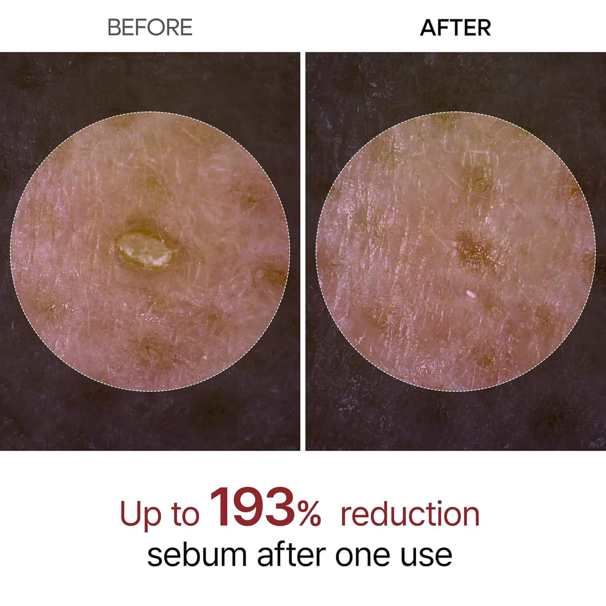 Dual-Action Rice Peel Ampoule & Scrub for Face and Body, Blackhead Remover